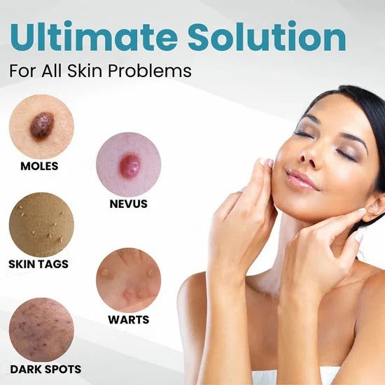 💎 LOVILDS™ Laser Pen – Safe, Painless & Effective Mole & Wart Removal