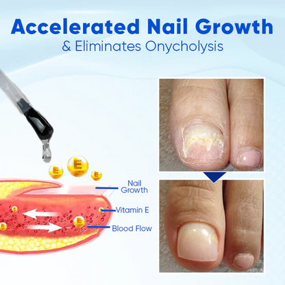Juxek® OnyxoGuard Nail Growth and Repair Serum