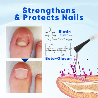 Juxek® OnyxoGuard Nail Growth and Repair Serum
