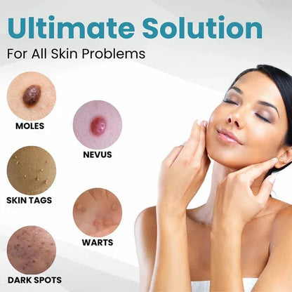 💎 LOVILDS™ Laser Pen – Safe, Painless & Effective Mole & Wart Removal