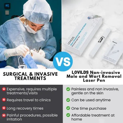 💎 LOVILDS™ Laser Pen – Safe, Painless & Effective Mole & Wart Removal
