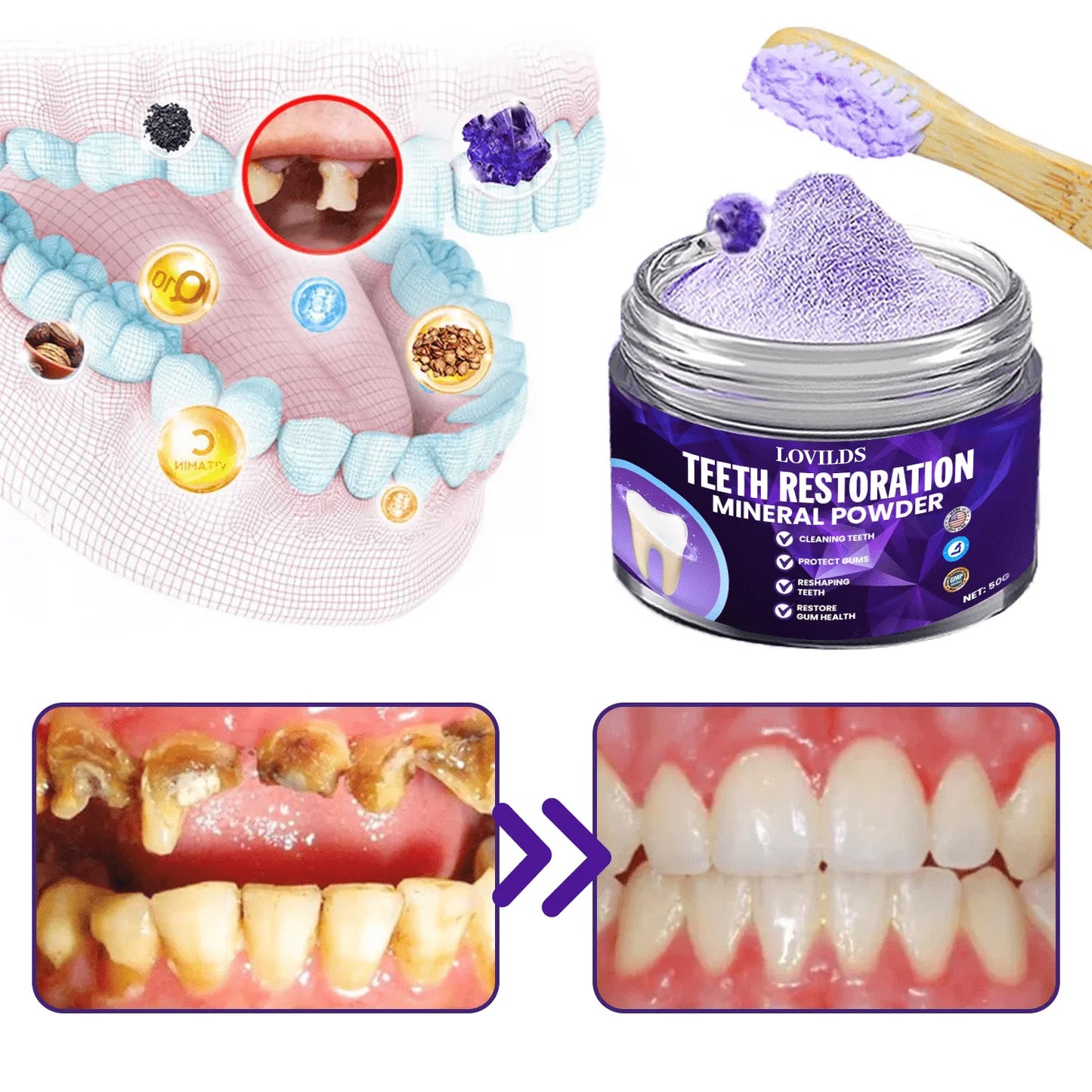 LOVILDS Dental Repair Mineral Powder⭐6