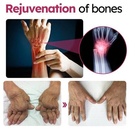 Slimoly™ Advanced Joint & Bone Renewal Cream